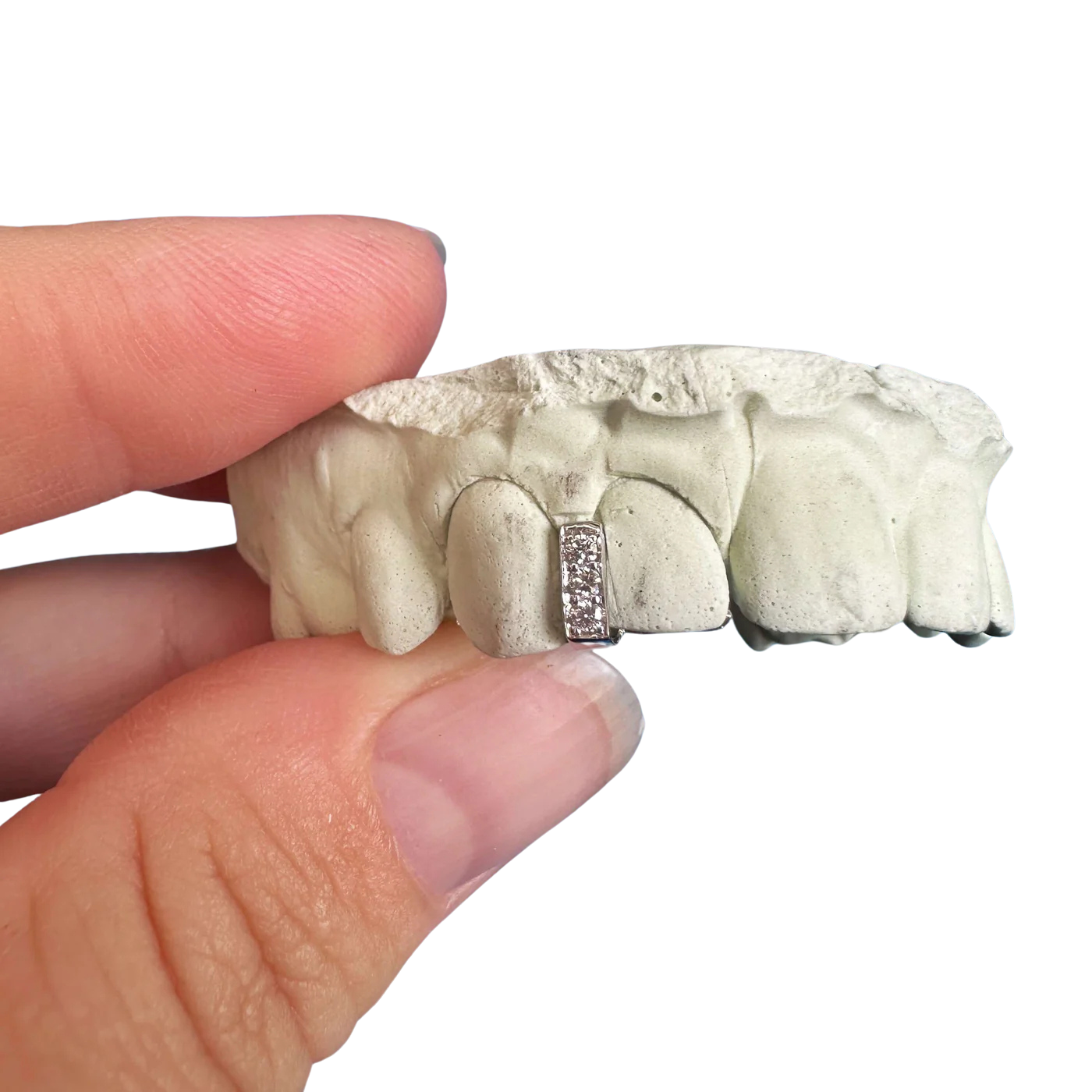 Diamond Gap Filler Grillz