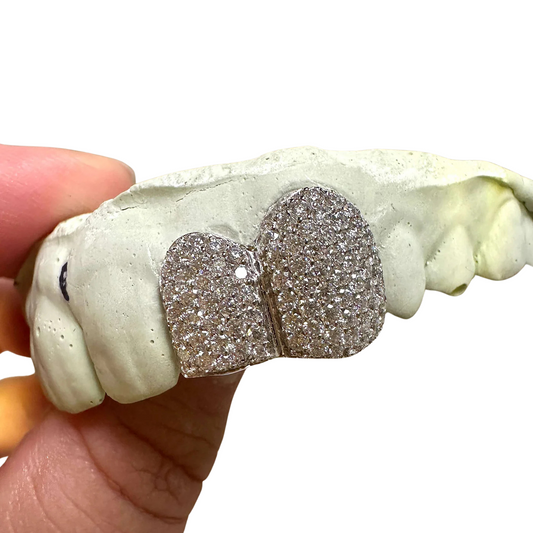 2 Piece Iced Out Diamond Grillz Set