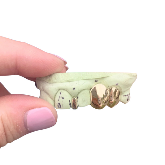 Solid Gap Filler Grillz