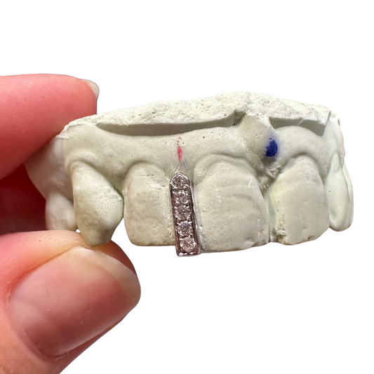 Diamond Gap Filler Grillz