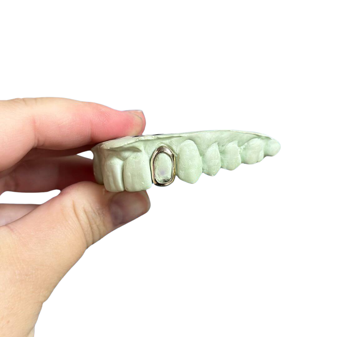 Single Open Face (Window) Cap – The Tooth Fairy NZ